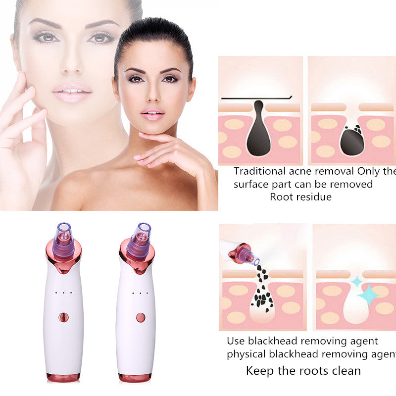 Blackhead remover instrument black dot remover acne vacuum suction face clean black head pore cleaning beauty skin care tool